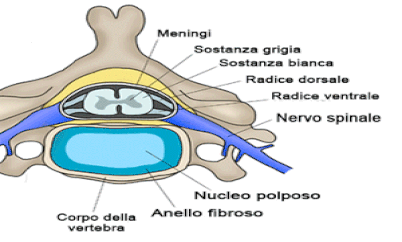 cervical disc hernia