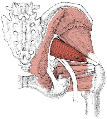 Piriformis syndrome - sciatica and back pain